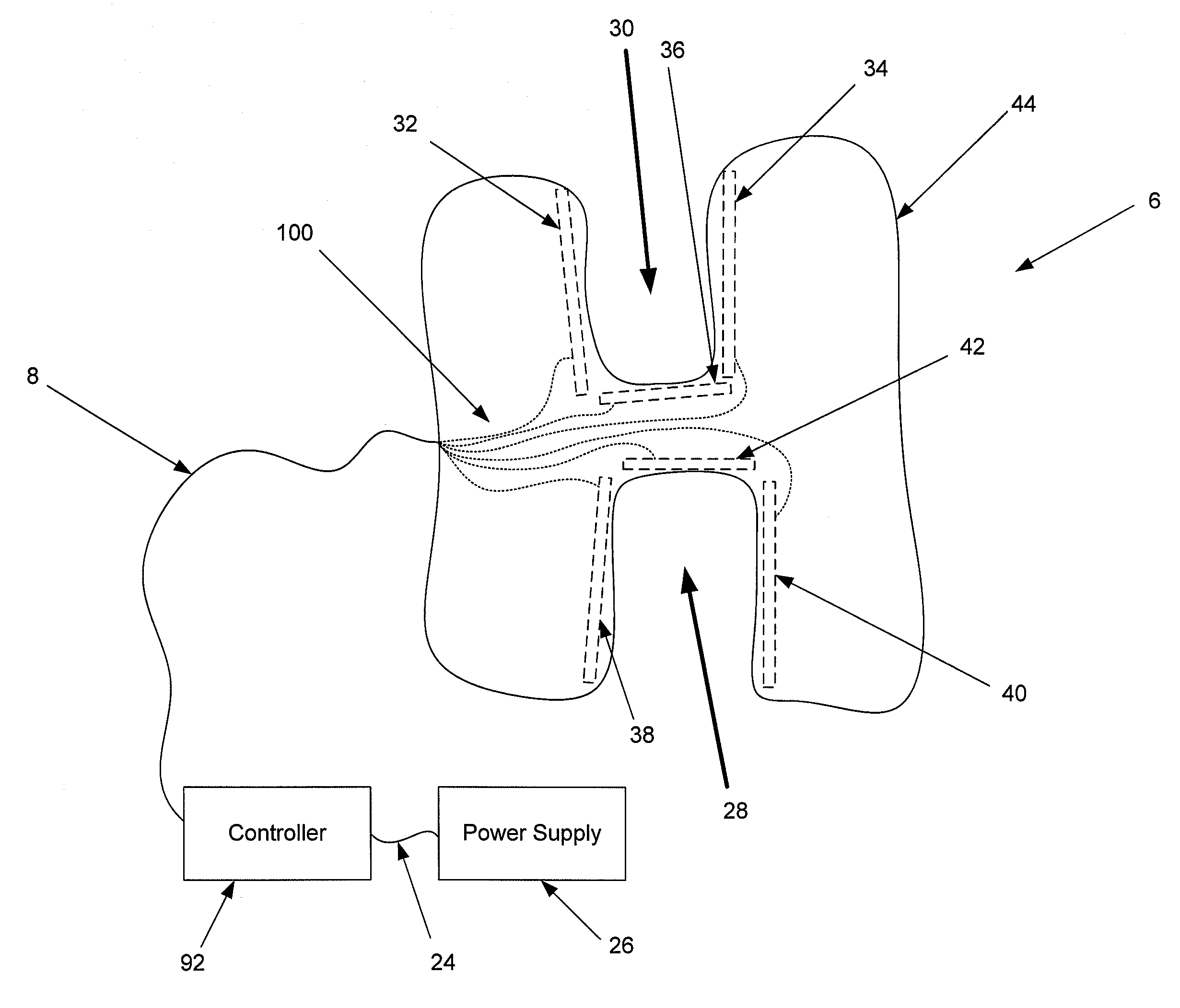 TODAY’S PATENT – SYSTEM AND METHOD FOR TEETH CLEANING 