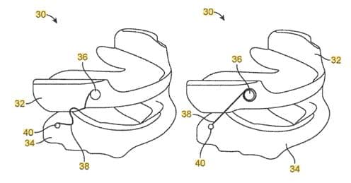 Today’s Patent – Devices for Positioning a Patient’s Mandible
