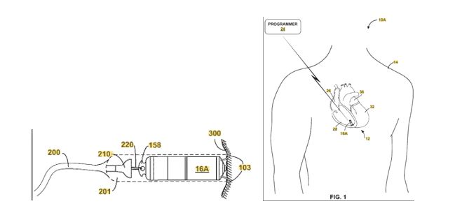 Today’s Patent - Implantable Medical Device Fixation