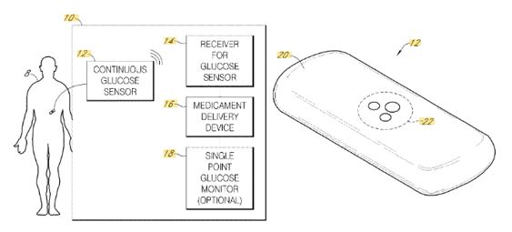 Today's Patent - Integrated Insulin Delivery System